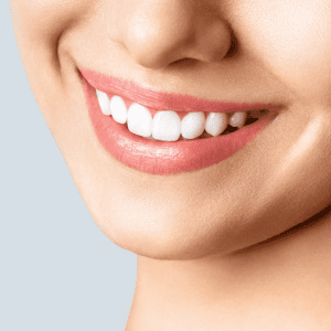 Smiling woman after marionette lines filler treatment
