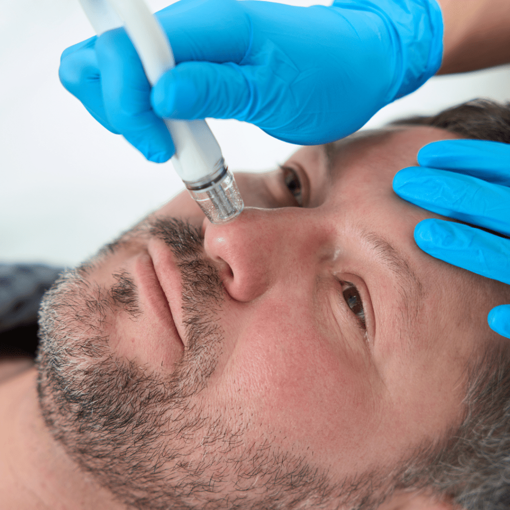 Microdermabrasion London Smooth, Glowing Skin at Omniya